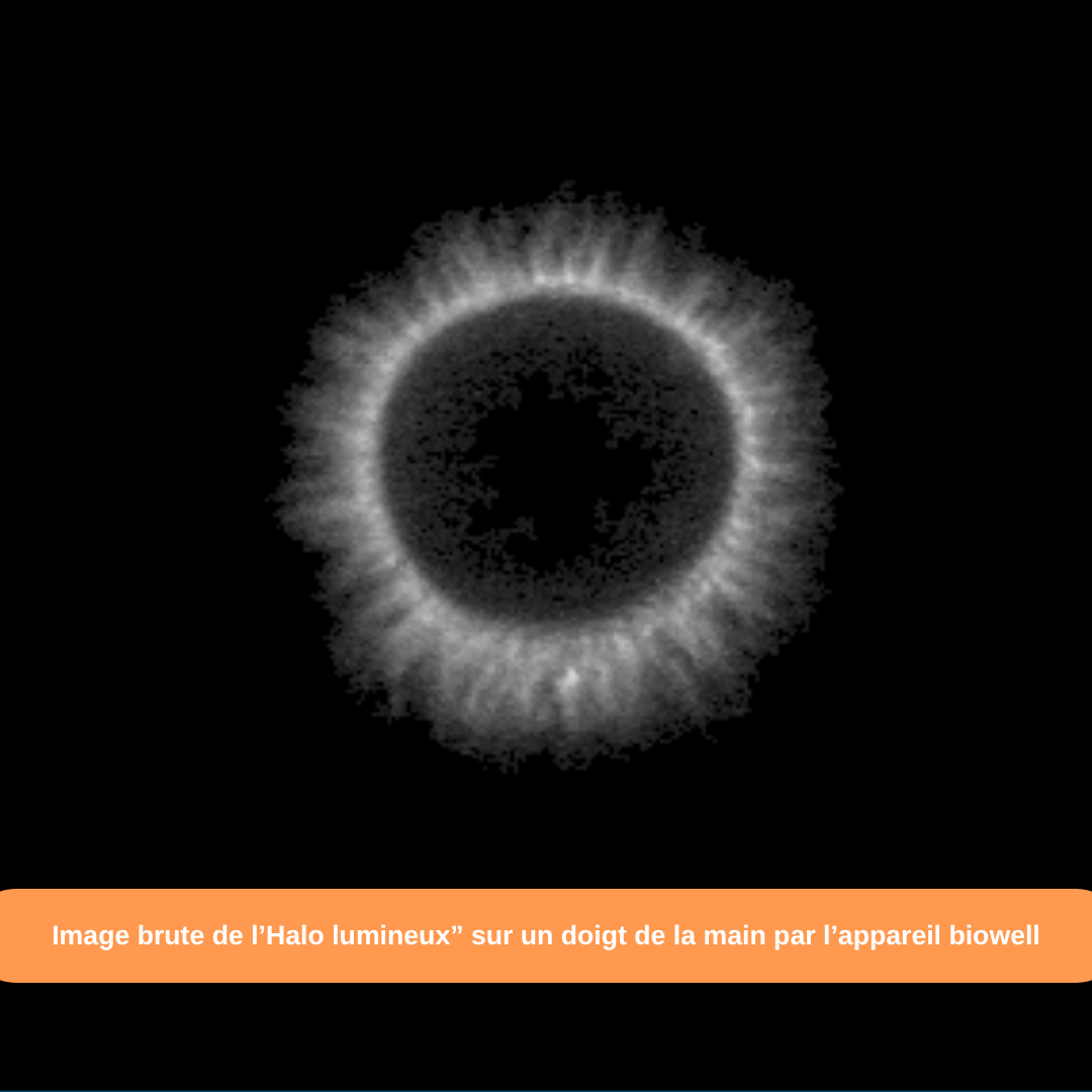 Effet Killian, Image biowell brute 
